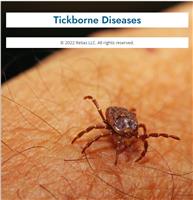 Tick-Borne Diseases