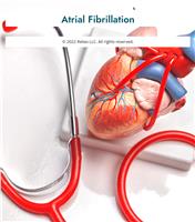 Atrial Fibrillation