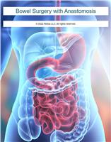 Bowel Surgery with Anastomosis