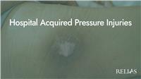 Hospital Acquired Pressure Injuries