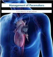 Management of Pacemaker