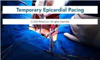 Temporary Epicardial Pacing