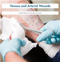 Venous and Arterial Wounds