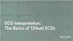 ECG Interpretation: The Basics of 12-Lead ECGs