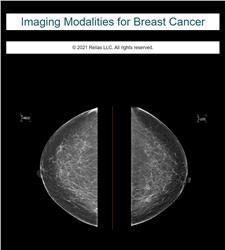 Imaging Modalities for Breast Cancer